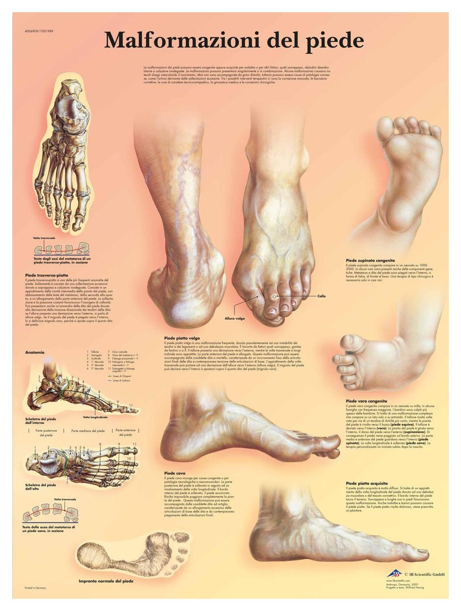 3b-scientific-lehrtafel-missbildungen-des-fu-es-vr4185l-anatomie-poster image 2