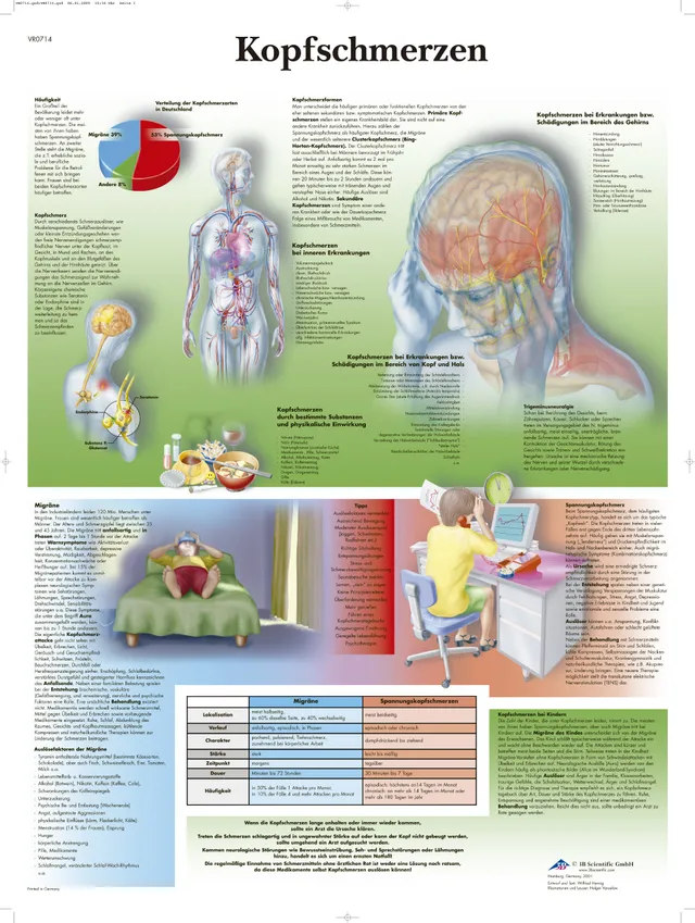 3b-scientific-lehrtafel-laminiert-kopfschmerzen-anatomie-poster-50x67-cm image 1