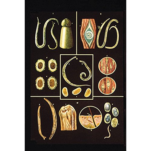 3b-scientific-lehrtafel-darmparasiten-ii-anatomie-wandkarte-84x200-cm-mit-holzbe image 3