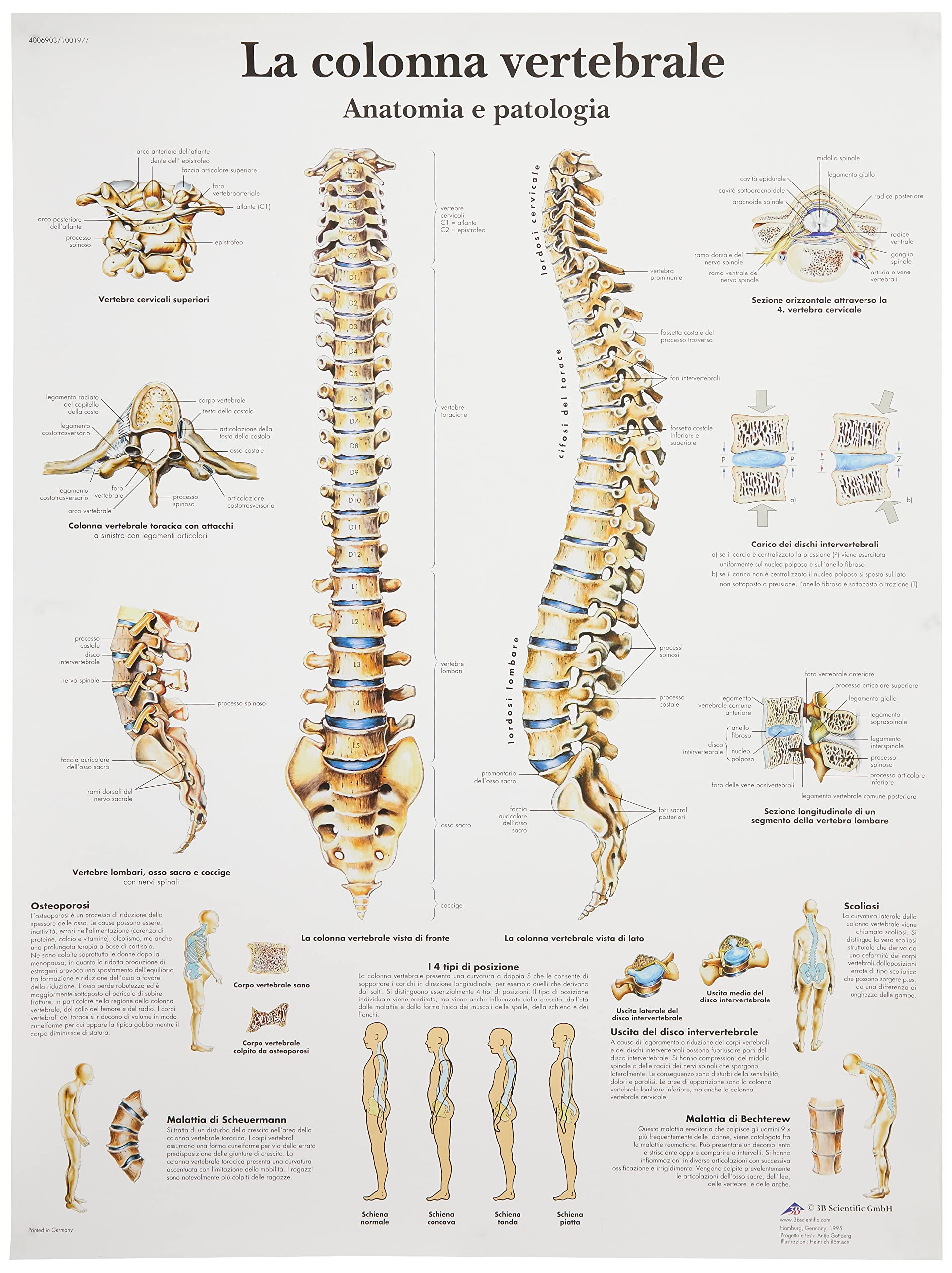 3b-scientific-wirbels-ule-und-wirbels-ulenpathologien-anatomietafel-papier image 1