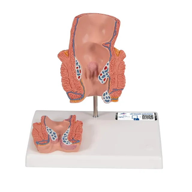 3b-scientific-h-morrhoidenmodell-enddarm-frontalschnitt-3b-smart-anatomy-app image 1