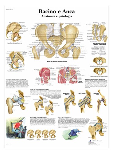 3b-scientific-vr4172l-poster-becken-und-h-fte-anatomie-und-pathologie image 3