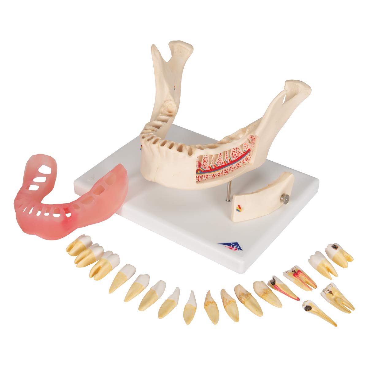 3b-scientific-zahnerkrankungsmodell-2-fach-vergr-ert-21-teilig-smart-anatomy-app image 3