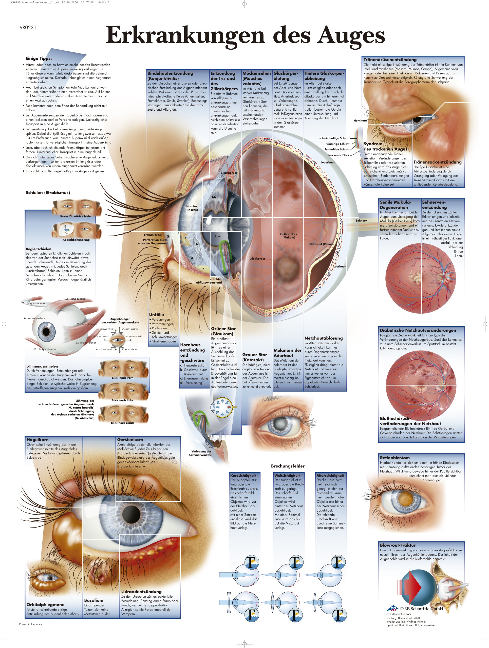 3b-scientific-lehrtafel-erkrankungen-des-auges-vr0231uu-anatomie-poster-50-x-67- image 1