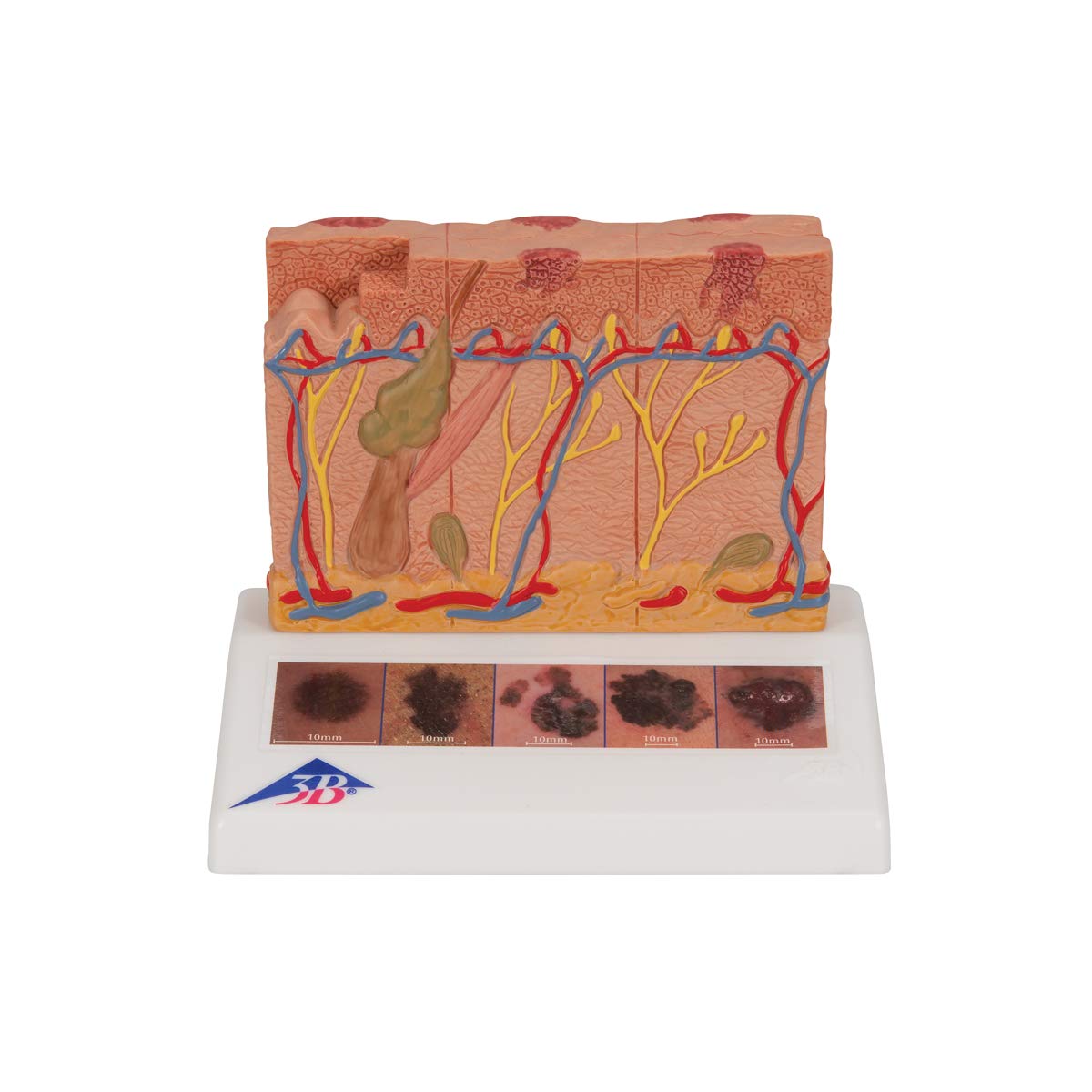 3b-scientific-hautschnitt-modell-feinstruktur-der-haut-mit-nagel-smart-anatomy-a image 3