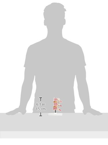 3b-scientific-osteoporose-modell-luxus-3-lendenwirbel-auf-stativ-mit-smart-anato image 5