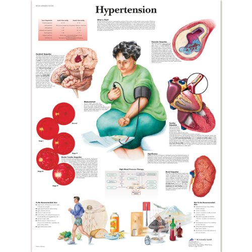 3b-scientific-hypertonie-diagramm-papier-50-x-67-cm-anatomie-lehrtafel-bluthochd image 6