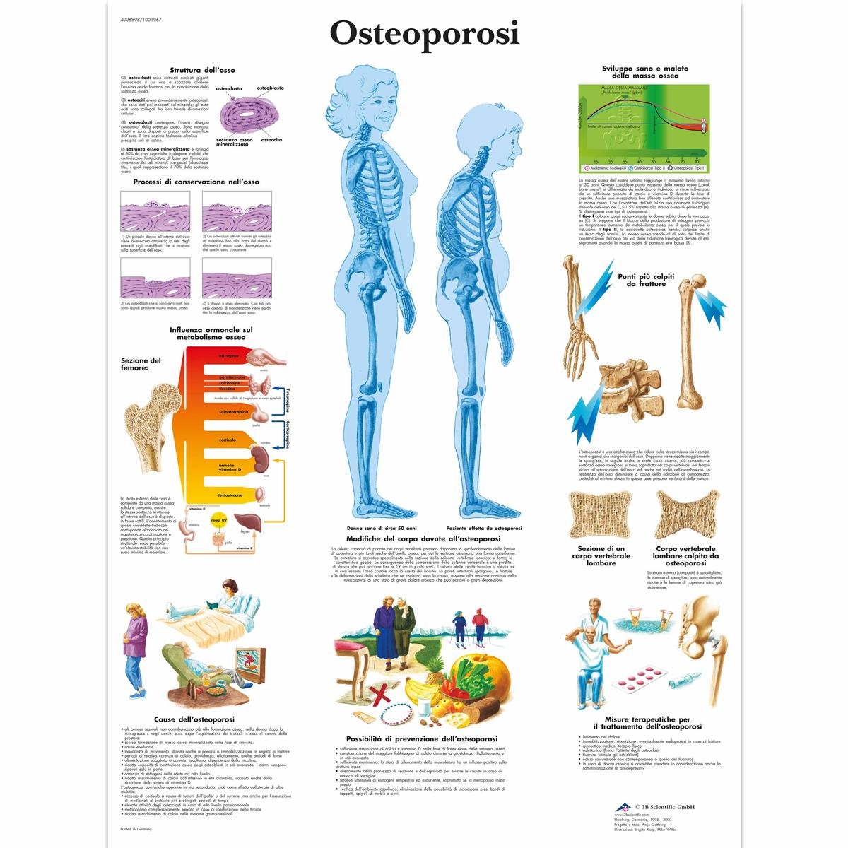 3b-scientific-anatomie-poster-osteoporose-vr4121l-medizinische-lehrtafel image 1