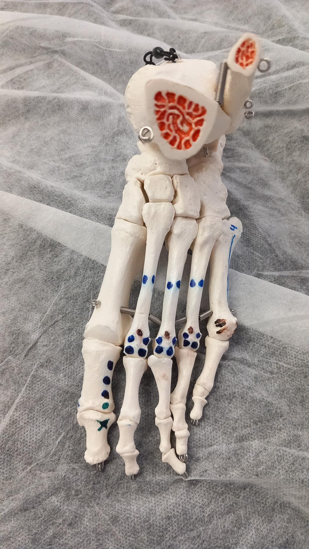 Gold wert in der Physio
