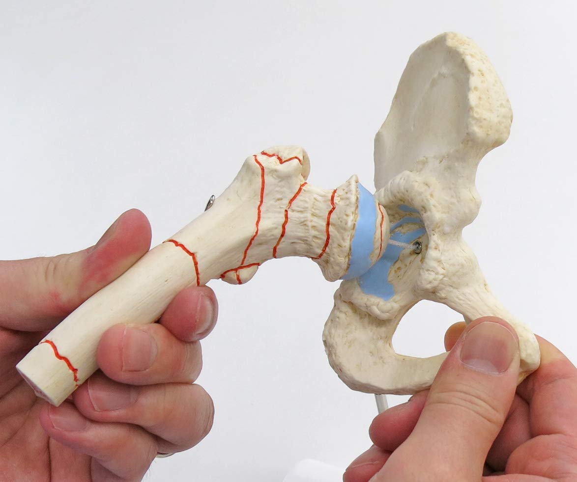 3b-scientific-h-ftgelenkmodell-mit-oberschenkelbruch-und-arthrose-pvc image 2