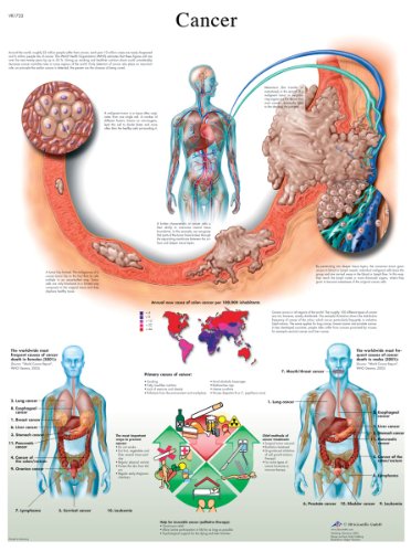3b-scientific-krebs-anatomie-lehrtafel-cancer-chart-papierposter-50-x-67-cm image 4