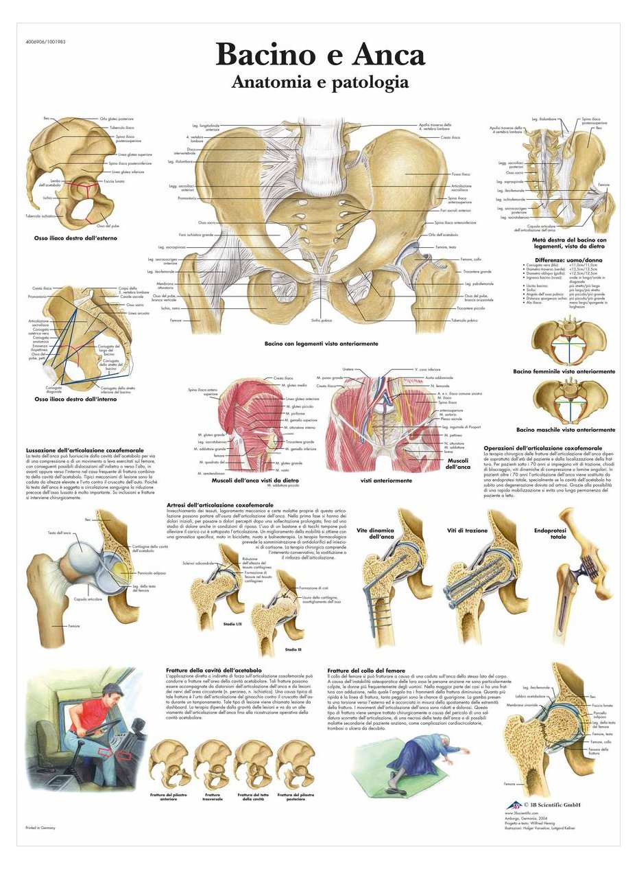 3b-scientific-vr4172l-poster-becken-und-h-fte-anatomie-und-pathologie image 2