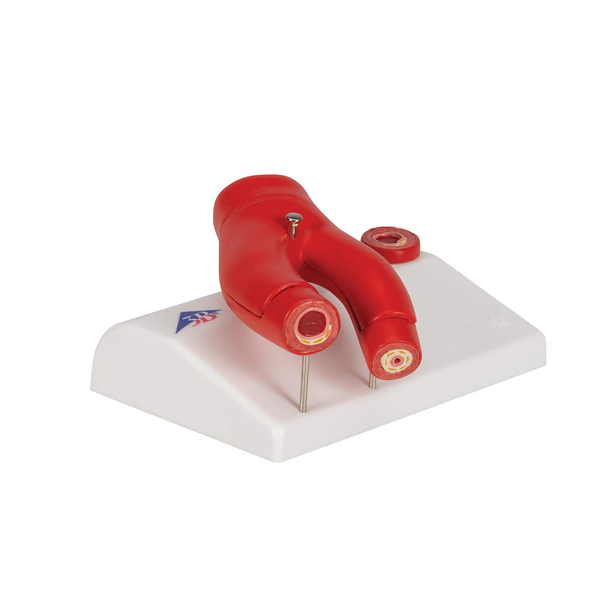 3b-scientific-arteriosklerose-modell-2-teilig-arterien-querschnitt-gesund-erkran image 2