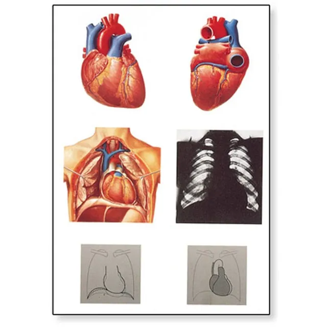 3b-scientific-lehrtafel-das-herz-i-anatomie-poster-84x200-cm-mit-holzbest-bung image 1