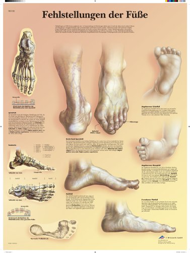 3b-scientific-lehrtafel-fehlstellungen-der-f-e-vr0185l-laminiertes-poster-50x67- image 2