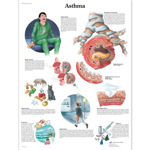 3b-scientific-asthma-laminierte-anatomie-lehrtafel-pathologieposter-50-x-67-cm image 2