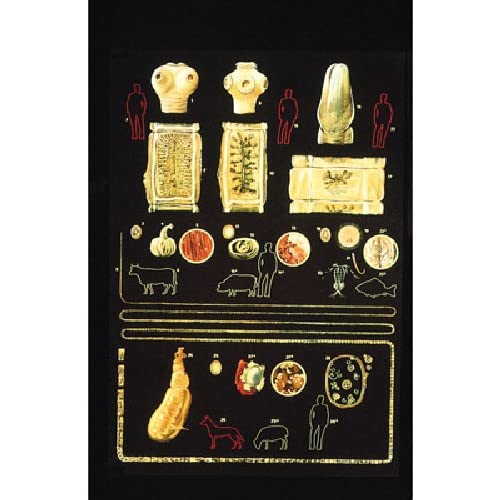 3b-scientific-menschliche-anatomie-lehrtafel-darmparasiten-i-84x200-cm-mit-holzb image 1