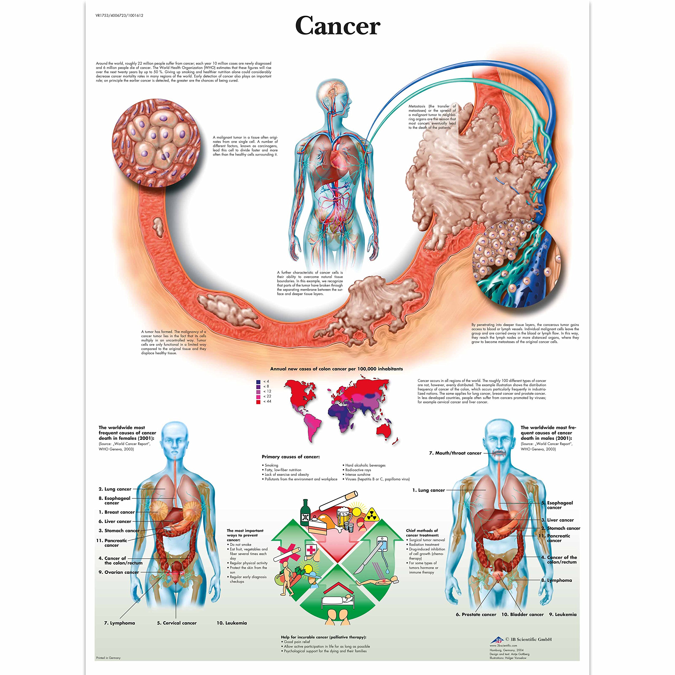 3b-scientific-krebs-anatomie-lehrtafel-cancer-chart-papierposter-50-x-67-cm image 1
