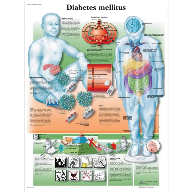 3b-scientific-lehrtafel-diabetes-mellitus-50-x-67-cm-unlaminiert image 1