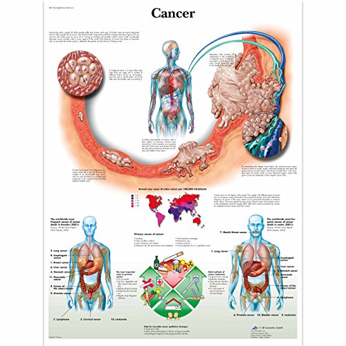3b-scientific-krebs-anatomie-lehrtafel-cancer-chart-papierposter-50-x-67-cm image 3