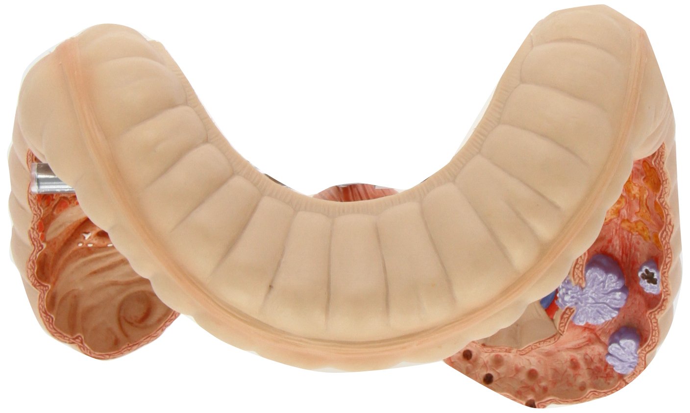3b-scientific-dickdarm-modell-k55-anatomie-verdauung image 5