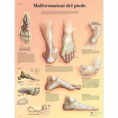 3b-scientific-lehrtafel-missbildungen-des-fu-es-vr4185l-anatomie-poster image 3