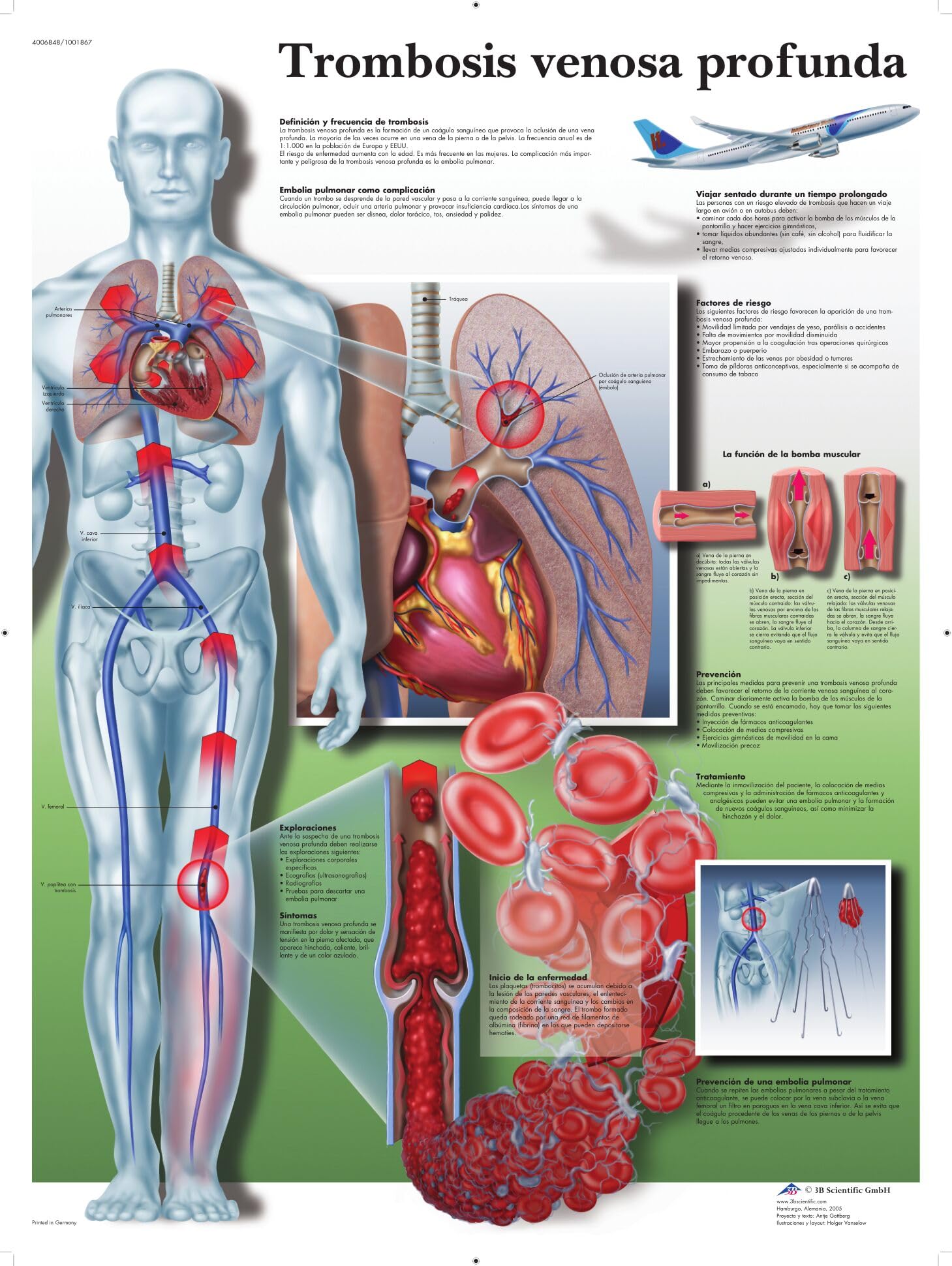 3b-scientific-lehrtafel-tiefe-venenthrombose-anatomie-poster-papier image 1