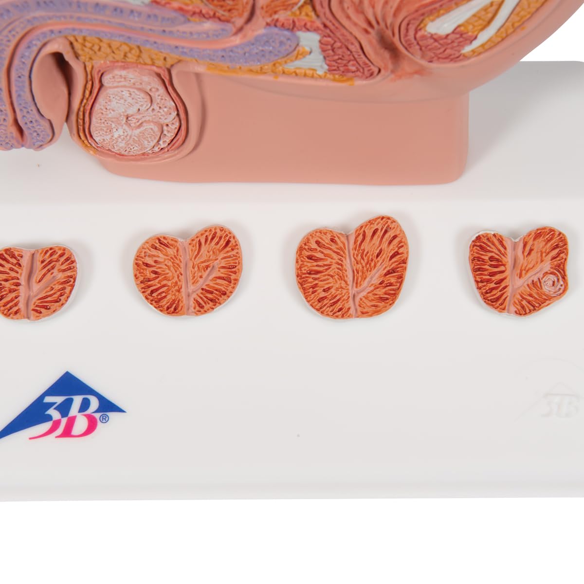 3b-scientific-prostata-modell-halbe-gr-e-auf-sockel-3b-smart-anatomy-app image 6
