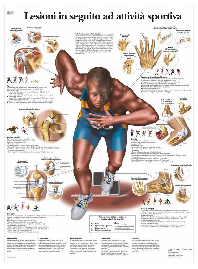 3b-scientific-anatomietafel-sportverletzungen-italienisch-50x67-cm-papier image 1