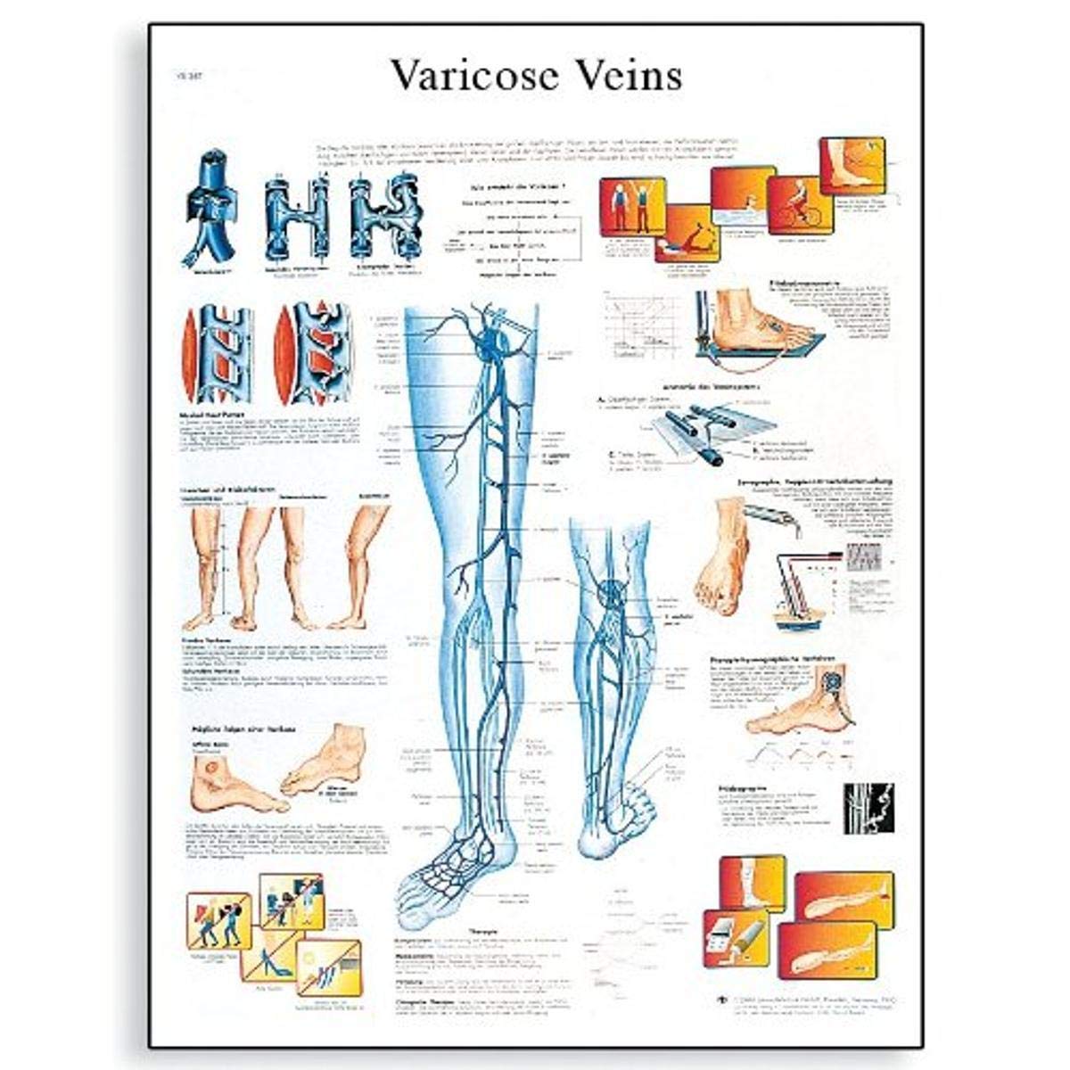 3b-scientific-lehrtafel-varicose-veins-englisch-laminiert-50-x-67-cm image 2