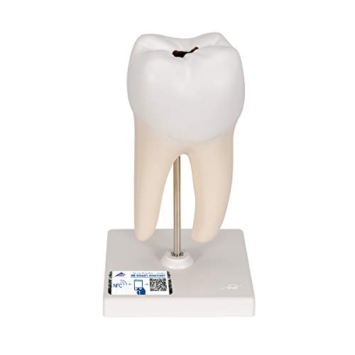 3b-scientific-unterer-molar-2-wurzelig-zahnmodell-mit-karies-2-teilig-app image 2