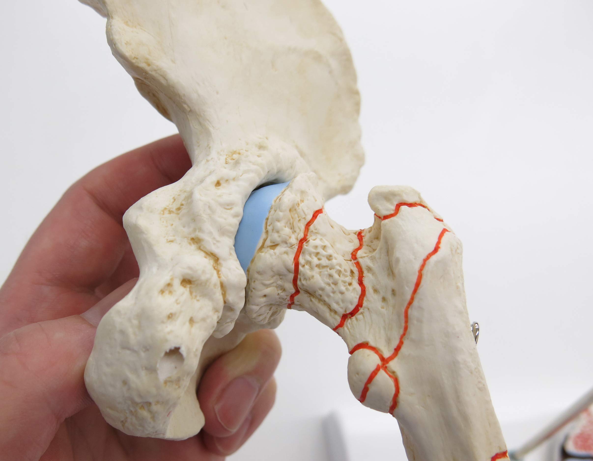 3b-scientific-h-ftgelenkmodell-mit-oberschenkelbruch-und-arthrose-pvc image 3