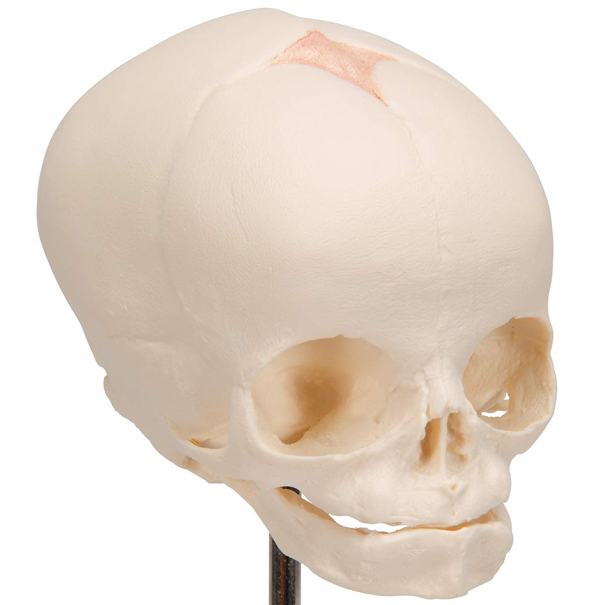 3b-scientific-f-tus-sch-del-naturabguss-30-ssw-auf-stativ image 8