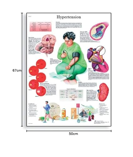 3b-scientific-hypertonie-diagramm-papier-50-x-67-cm-anatomie-lehrtafel-bluthochd image 5