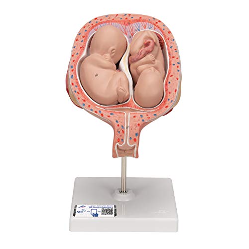 3b-scientific-zwillingsfeten-5-monat-normale-position-3b-smart-anatomy-app image 4