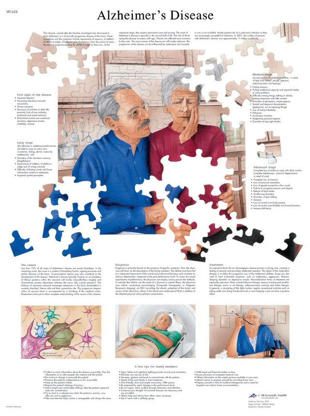 3b-scientific-alzheimer-krankheit-laminierte-anatomie-lehrtafel-50-x-67-cm image 1