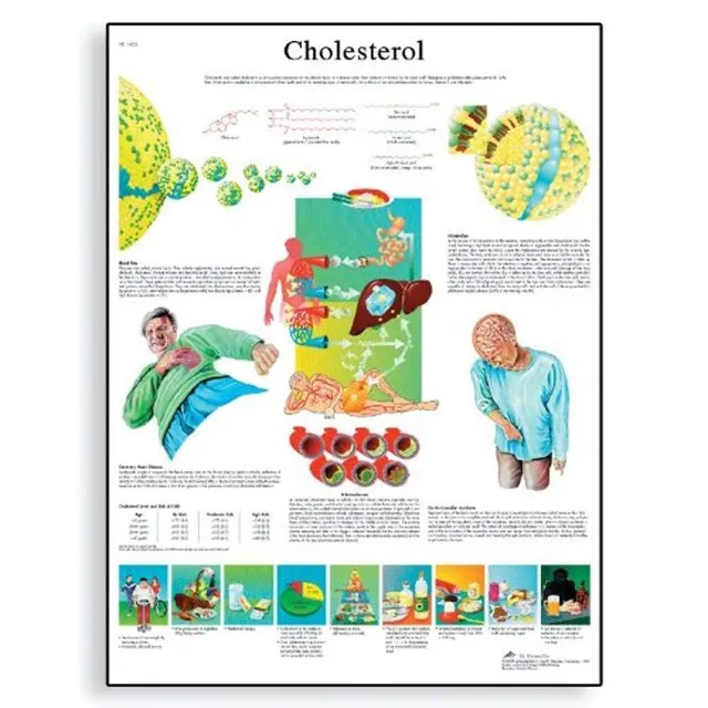 3b-scientific-lehrposter-cholesterin-medizinisches-wandposter image 1