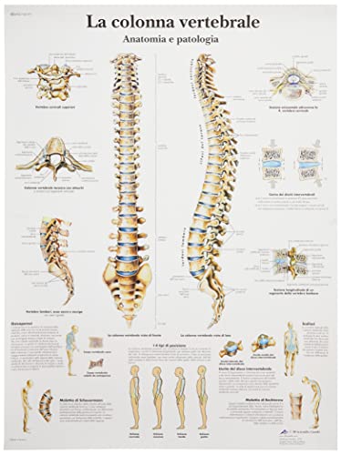 3b-scientific-wirbels-ule-und-wirbels-ulenpathologien-anatomietafel-papier image 5