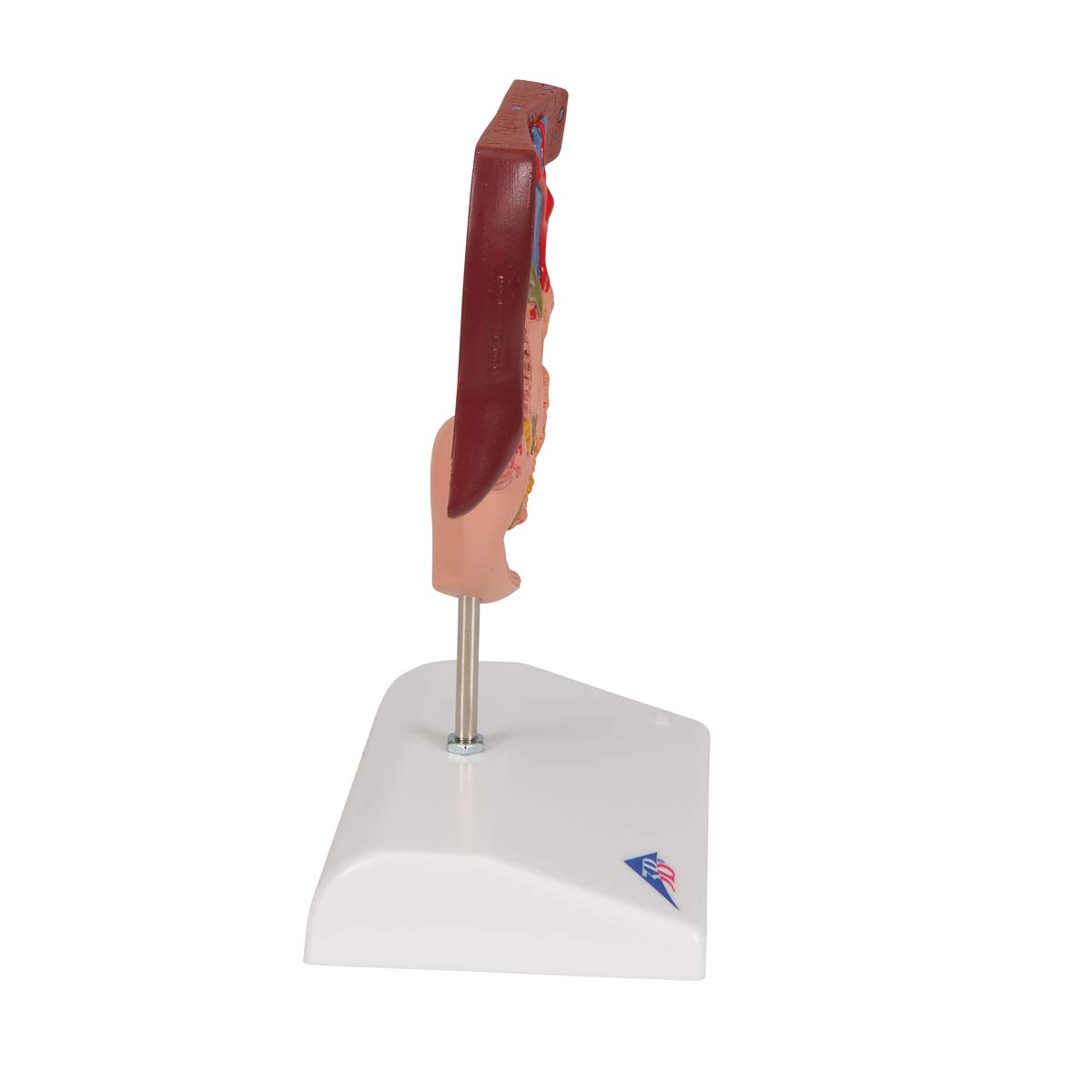 3b-scientific-gallenstein-modell-gallenblasenanatomie-mit-gallensteinbildungen-a image 3
