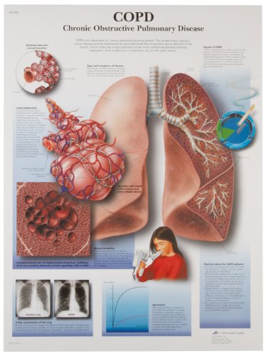 3b-scientific-copd-chronisch-obstruktive-lungenerkrankung-laminierte-lehrtafel-5 image 4