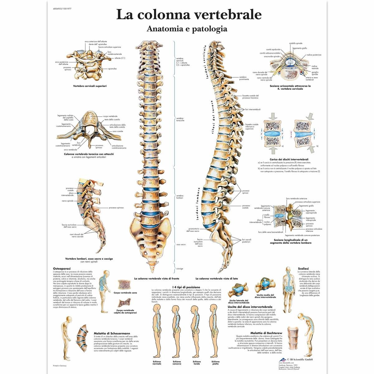 3b-scientific-wirbels-ule-und-wirbels-ulenpathologien-anatomietafel-papier image 4