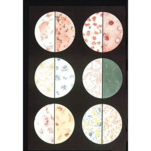 3b-scientific-bakterien-lehrtafel-84-x-200-cm-mit-holzst-bung image 3