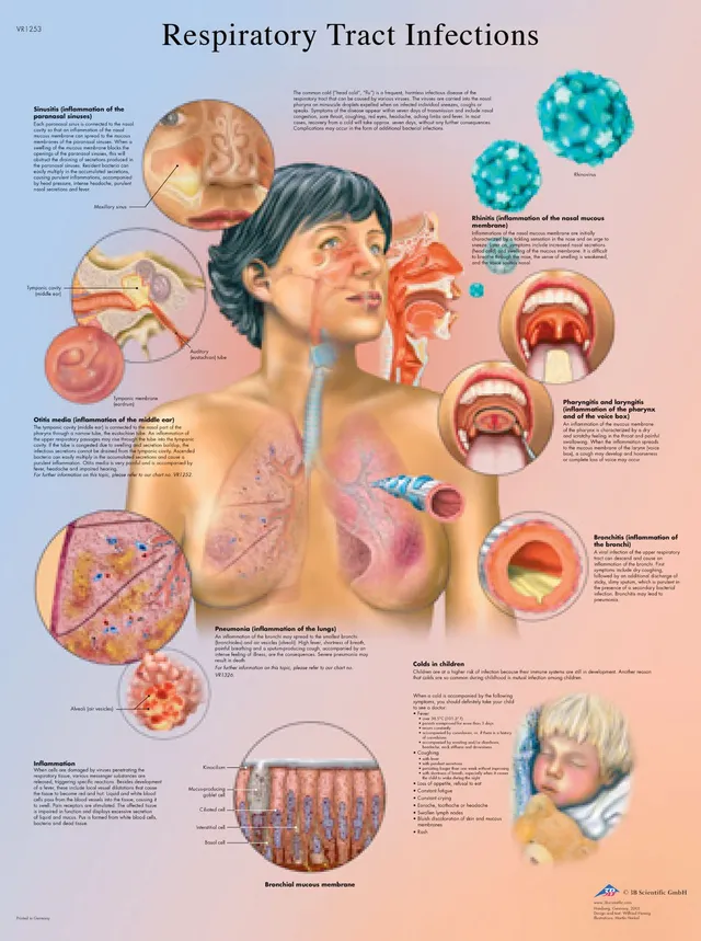 3b-scientific-lehrtafel-atemwege-infektionen-laminiert-50-8-x-66-cm image 1