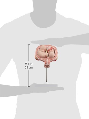 3b-scientific-zwillingsfeten-5-monat-normale-position-3b-smart-anatomy-app image 7
