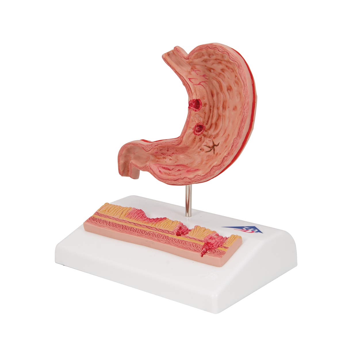 3b-scientific-magenmodell-mit-geschw-ren-humananatomie-modell-aus-pvc-smart-anat image 2