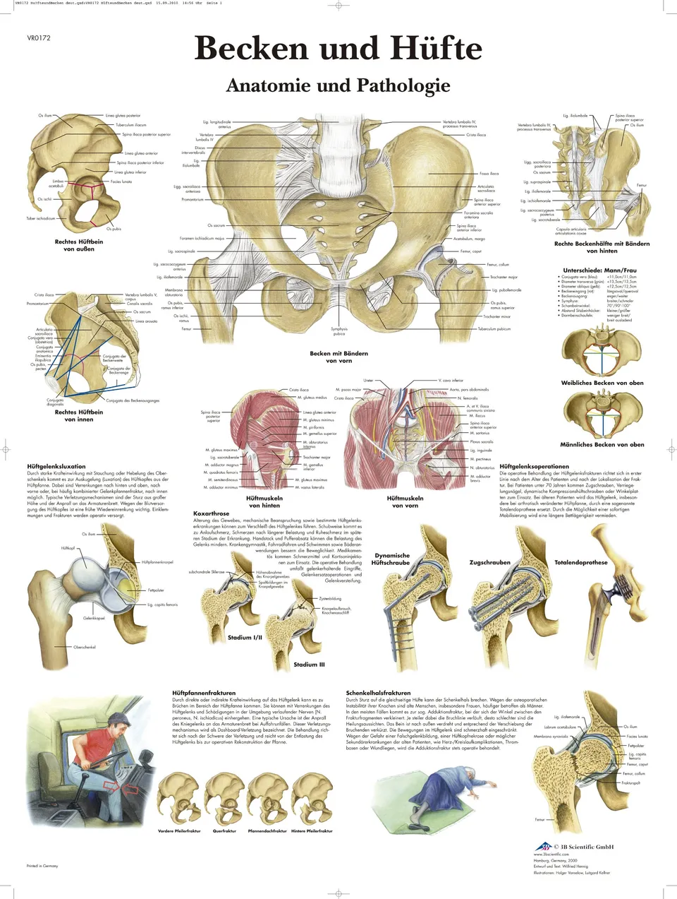 3b-scientific-laminierte-becken-h-fte-tafel-anatomie-pathologie-poster-50x67-cm image 1