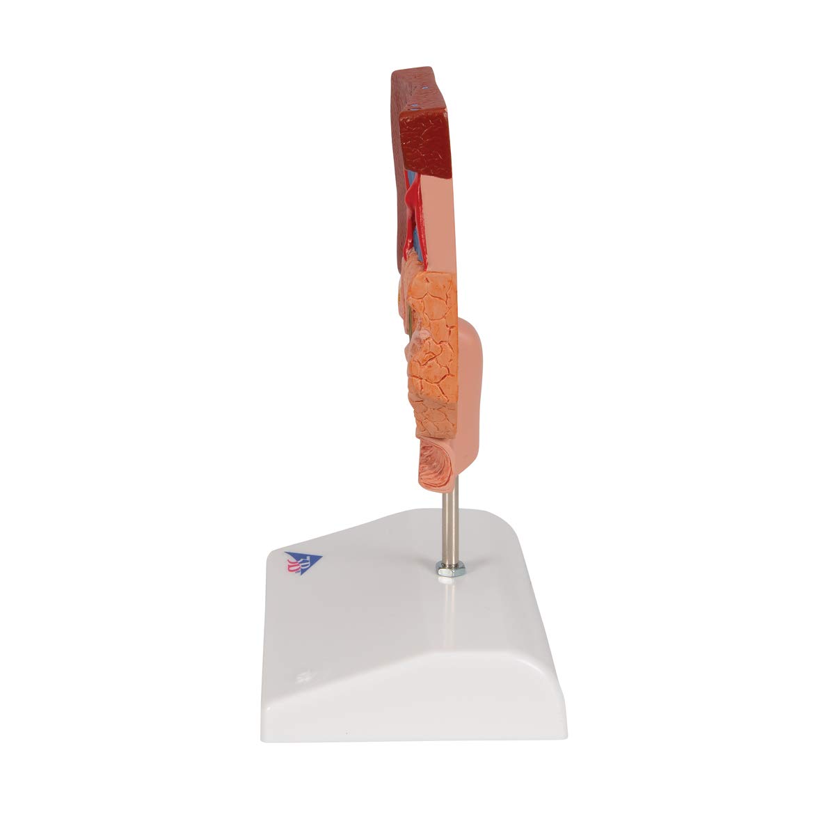 3b-scientific-gallenstein-modell-gallenblasenanatomie-mit-gallensteinbildungen-a image 4