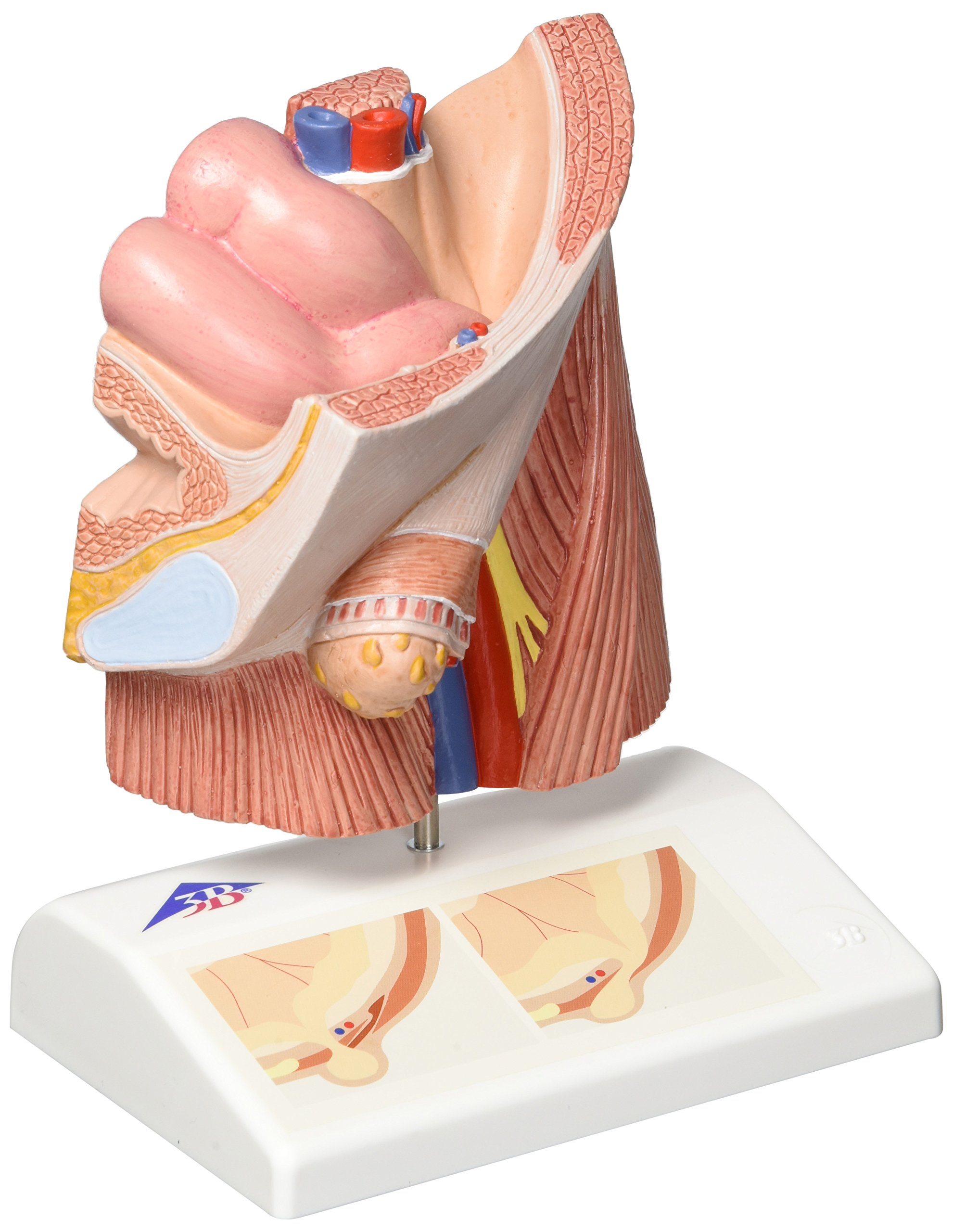 3b-scientific-leistenbruchmodell-nat-rliche-gr-e-anatomiemodell-leistenregion-ma image 1