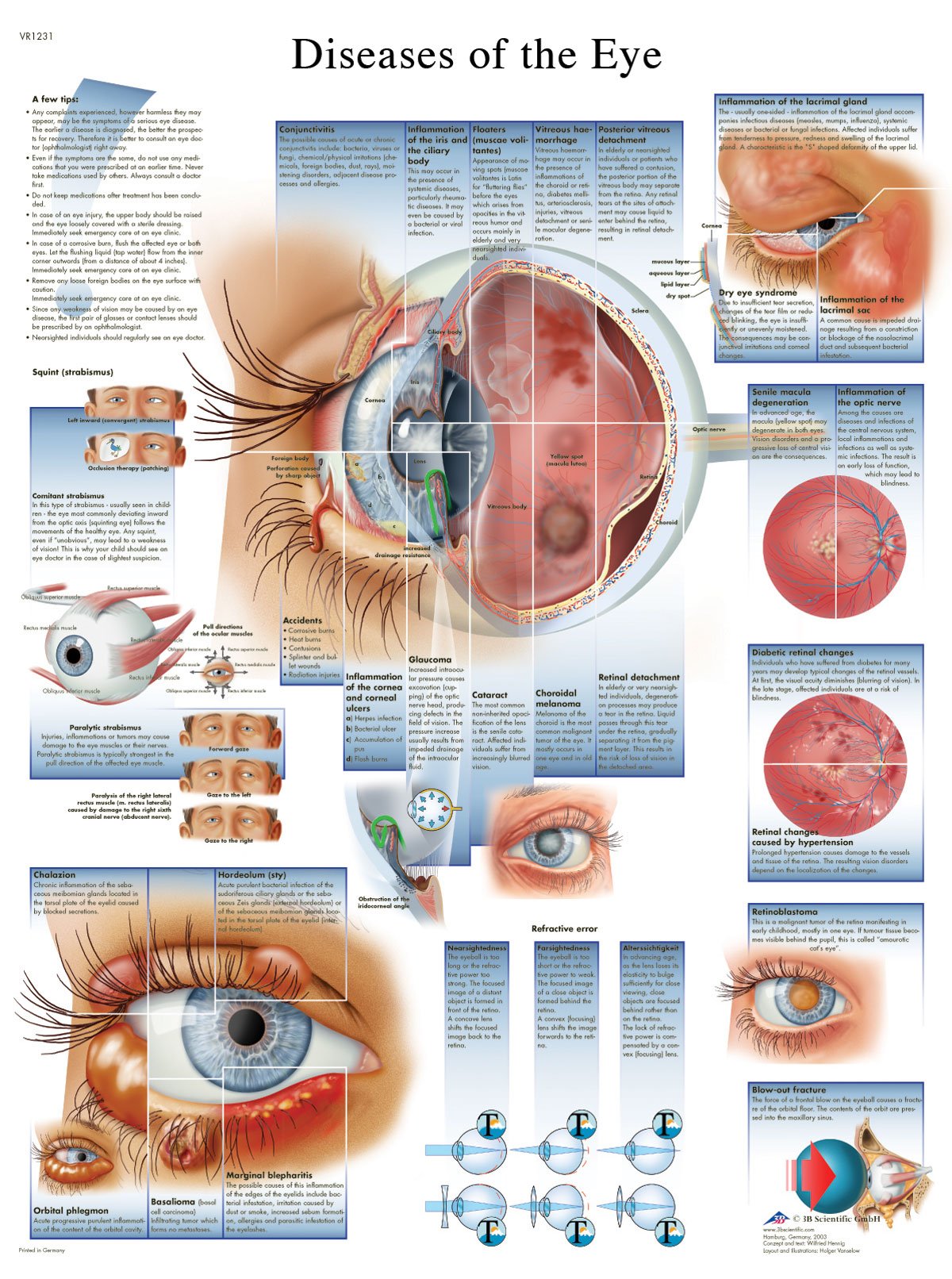 3b-scientific-krankheiten-des-auges-tafel-vr1231uu-unlaminiert-50x67-cm image 2