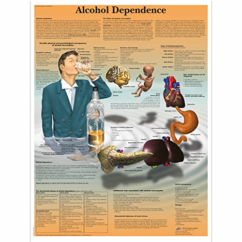 3b-scientific-lehrtafel-alkoholabh-ngigkeit-laminiertes-anatomie-poster-50-x-67- image 4